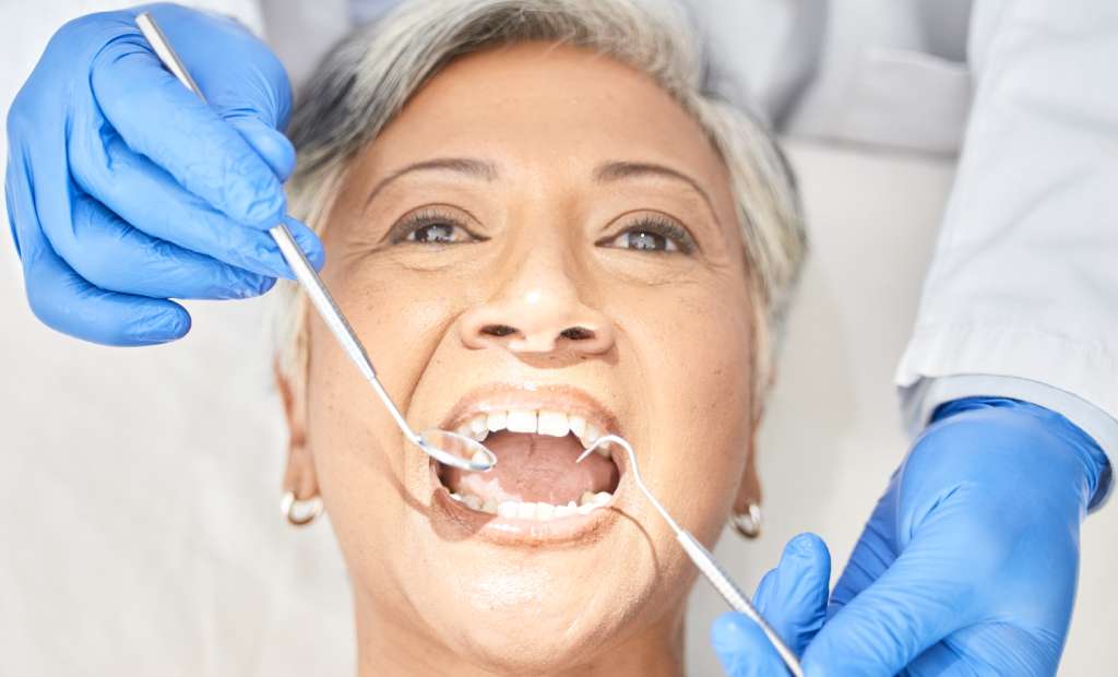 Full Mouth Reconstruction