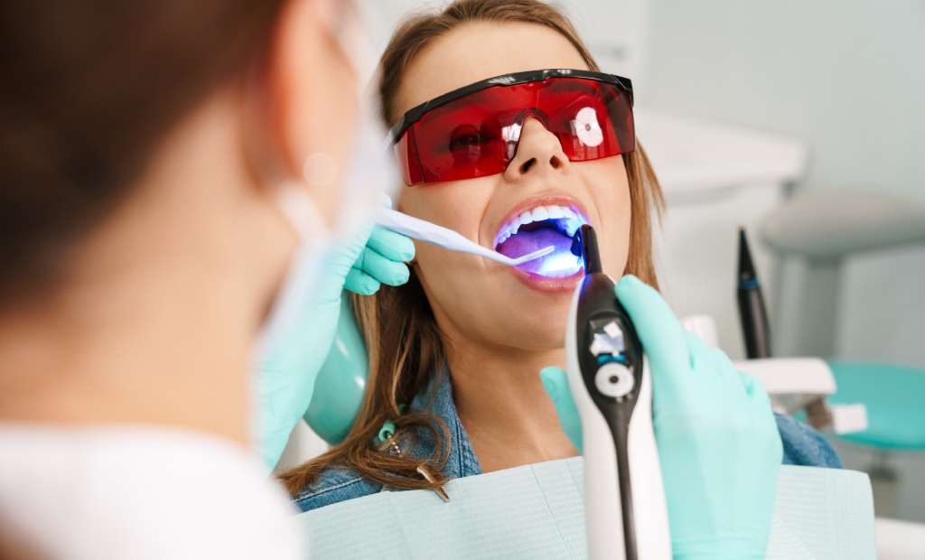 modern fillings and sealants