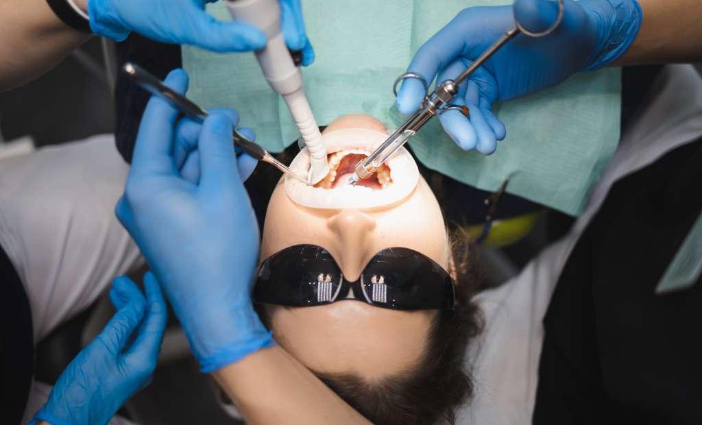teeth removal