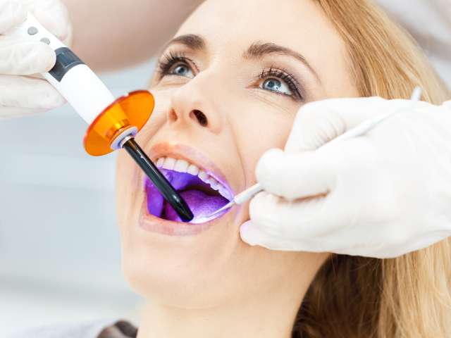 dental sealants