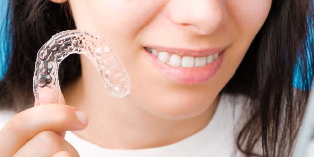 Clear, Removable Aligners