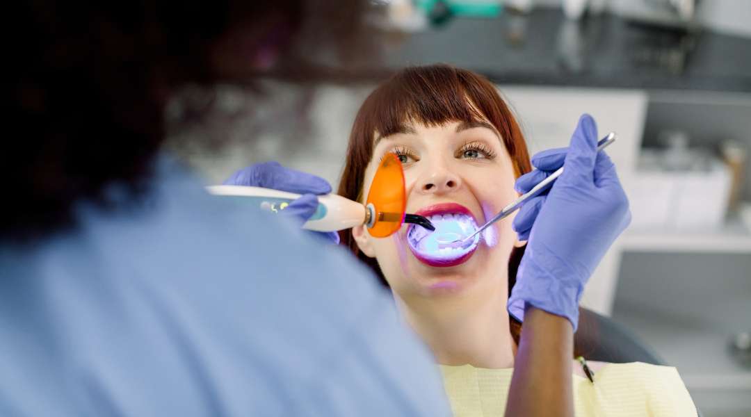 dental bonding service