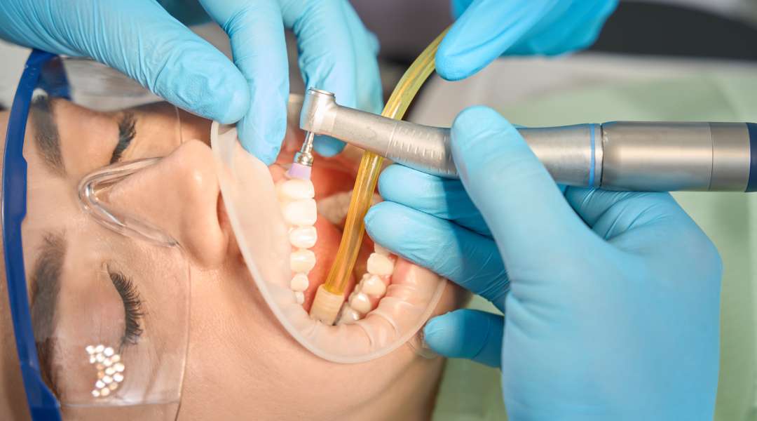 periodontal maintenance cleaning