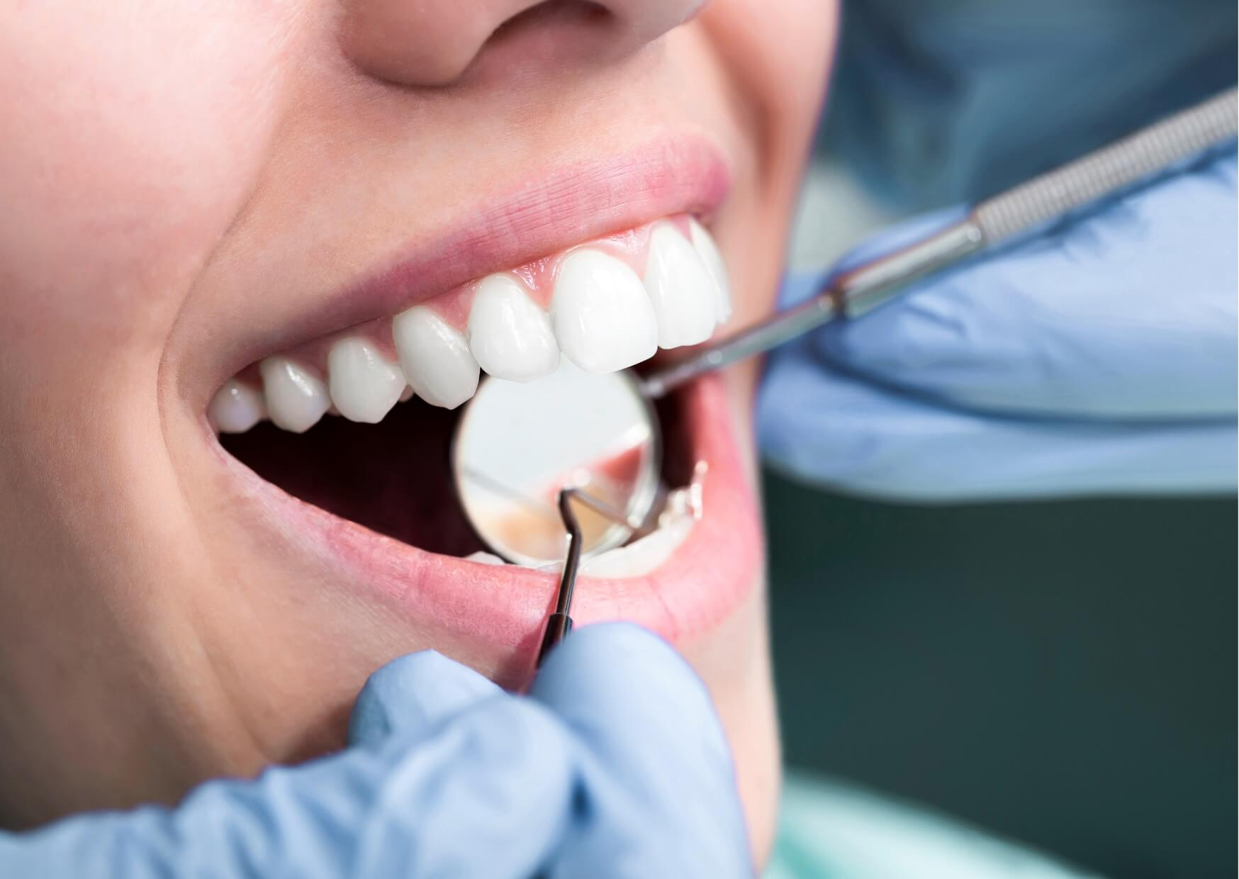 Dentist examining a patient's smile during a consultation to help decide between dental crowns and veneers.