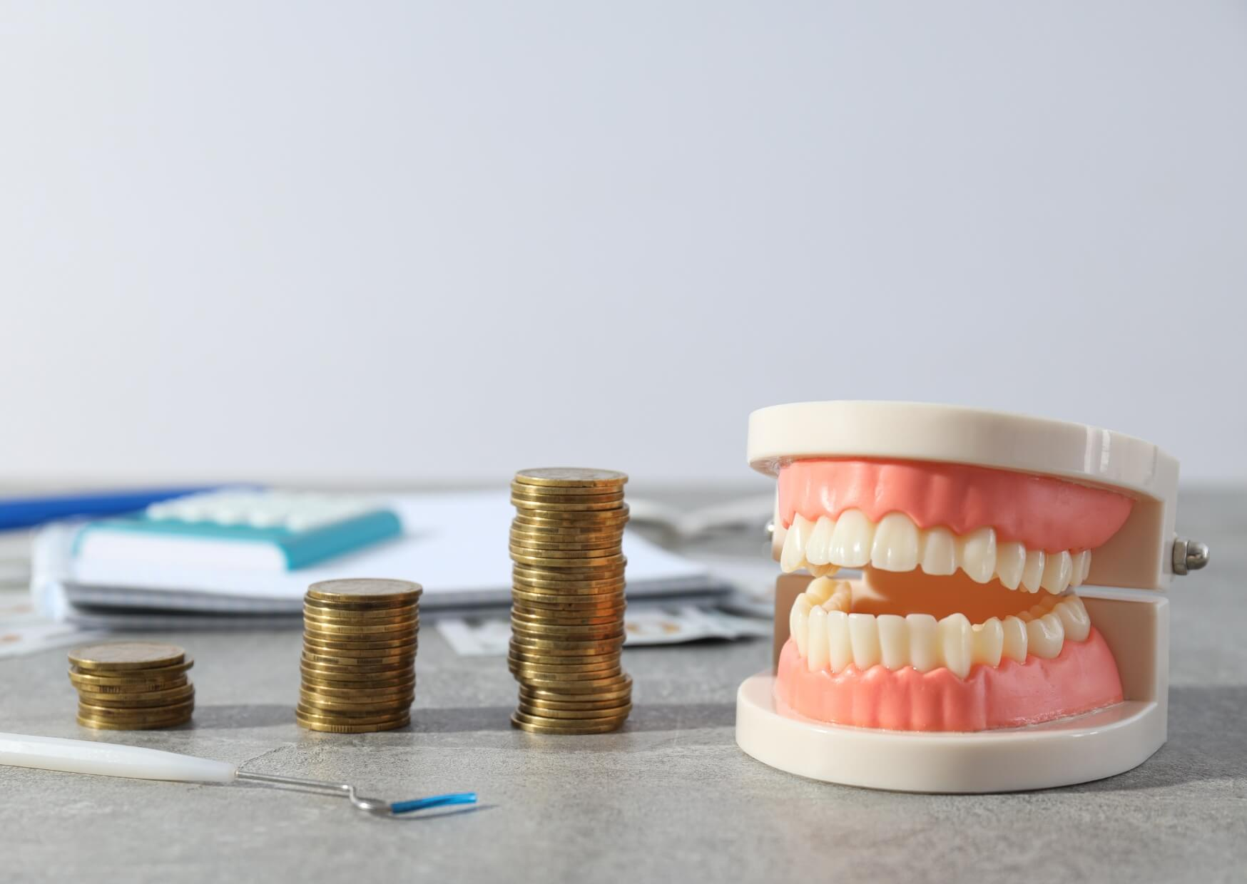Dental model beside stacks of coins illustrating how veneer costs can vary by location and dental practice.