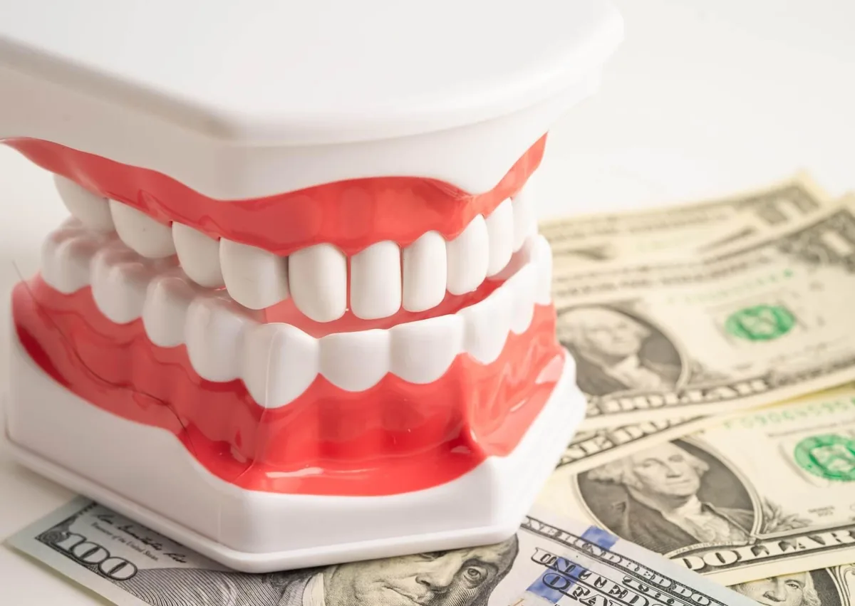 Dental model with money illustrating the cost of dental bonding treatment.