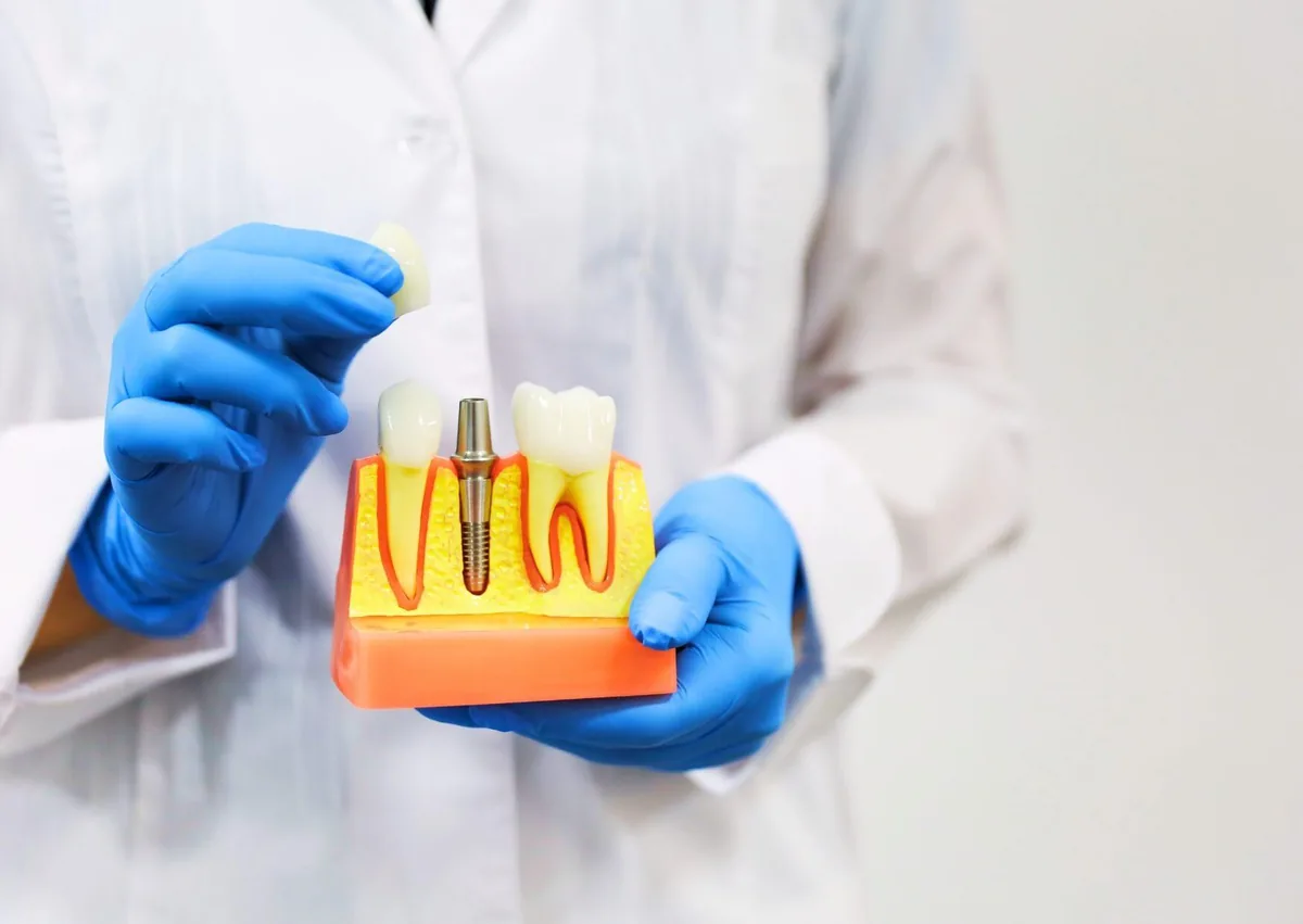 Dental professional holding a model that demonstrates the tooth implant placement process and restoration timeline.